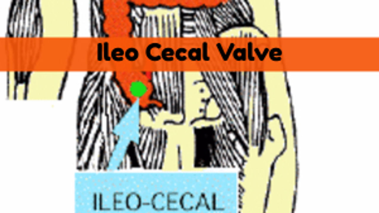 Ileo Cecal Valve